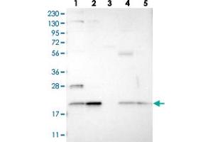 Western blot analysis of Lane 1: RT-4, Lane 2: U-251 MG, Lane 3: Human Plasma, Lane 4: Liver, Lane 5: Tonsil with TMEM65 polyclonal antibody  at 1:250-1:500 dilution. (TMEM65 anticorps)