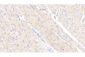 Detection of NDUFS1 in Human Cardiac Muscle Tissue using Polyclonal Antibody to NADH Dehydrogenase Ubiquinone Fe-S Protein 1 (NDUFS1)
