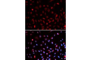 Immunofluorescence analysis of U2OS cells using ERCC1 antibody (ABIN5973037). (ERCC1 anticorps)