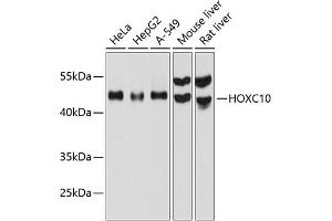 Western blot analysis of extracts of various cell lines, using HOXC10 antibody (ABIN6129025, ABIN6141948, ABIN6141949 and ABIN6215814) at 1:1000 dilution. (HOXC10 anticorps  (AA 1-260))