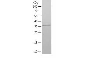 Western Blotting (WB) image for Antigen Identified By Monoclonal Antibody Ki-67 (MKI67) (AA 762-1016) protein (His tag) (ABIN7121860)