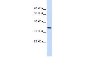 Annexin A4 antibody used at 1 ug/ml to detect target protein. (Annexin IV anticorps  (Middle Region))