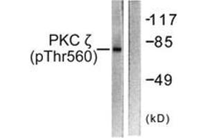 Western blot analysis of extracts from COS7 cells treated with PMA 125ng/ml 30', using PKC zeta (Phospho-Thr560) Antibody. (PKC zeta anticorps  (pThr560))