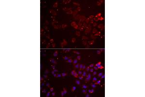 Immunofluorescence analysis of  cells using GATM antibody (ABIN6133283, ABIN6140984, ABIN6140985 and ABIN6222282).