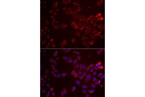 Immunofluorescence analysis of  cells using GATM antibody (ABIN6133283, ABIN6140984, ABIN6140985 and ABIN6222282). (GATM anticorps  (AA 124-423))