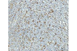 IHC analysis of Grp75 using anti-Grp75 antibody (ABIN7602782). (HSPA9 anticorps  (C-Term))