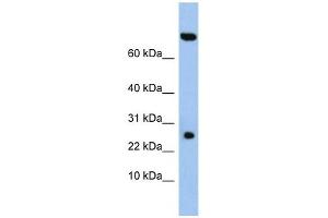 ZSWIM3 antibody used at 1 ug/ml to detect target protein. (ZSWIM3 anticorps  (N-Term))