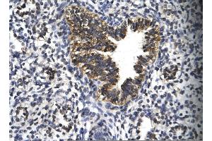 Rabbit Anti-EGR2 Antibody       Paraffin Embedded Tissue:  Human bronchiole epithelium   Cellular Data:  Epithelial cells of renal tubule  Antibody Concentration:   4. (EGR2 anticorps  (C-Term))