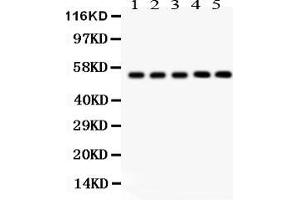 Anti-  YB1 Picoband antibody, Western blottingAll lanes: Anti YB1  at 0.