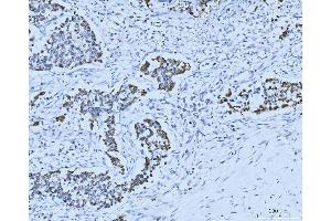 IHC analysis of MCM6 using anti-MCM6 antibody (ABIN7600037). (MCM6 anticorps  (AA 14-821))