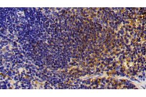 Detection of CTSS in Mouse Spleen Tissue using Polyclonal Antibody to Cathepsin S (CTSS)