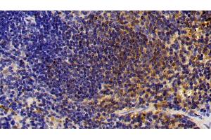Detection of CTSS in Mouse Spleen Tissue using Polyclonal Antibody to Cathepsin S (CTSS) (Cathepsin S anticorps  (AA 115-331))