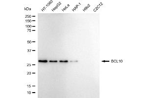 Western blotting analysis using BCL10 antibody (ABIN7800914).