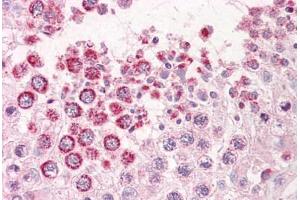 Anti-GAGED2 antibody IHC staining of human testis. (XAGE1D anticorps  (AA 58-69))