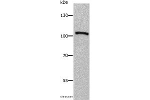 Western blot analysis of Human fetal brain tissue, using ADAMTS5 Polyclonal Antibody at dilution of 1:650 (ADAMTS5 anticorps)