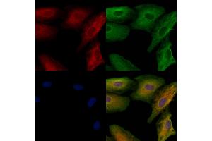 ABIN6259851 and ABIN6278727 staining  cells by IF/ICC. (AKAP12 anticorps  (C-Term))