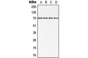 Western blot analysis of cIAP1 expression in HT29 (A), Jurkat (B), SP2/0 (C), PC12 (D) whole cell lysates. (BIRC2 anticorps  (Center))