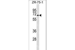 SG Antibody (C-term) (ABIN1537484 and ABIN2849754) western blot analysis in ZR-75-1 cell line lysates (35 μg/lane). (C9orf96 anticorps  (C-Term))