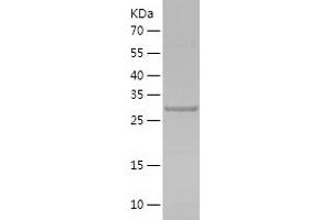 Western Blotting (WB) image for Insulin-Like Growth Factor Binding Protein 7 (IGFBP7) (AA 27-282) protein (His-IF2DI Tag) (ABIN7123465)