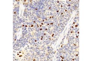 Immunohistochemistry of paraffin embedded mouse spleen using IL-27A (ABIN7074367) at dilution of 1: 400 (400x lens)