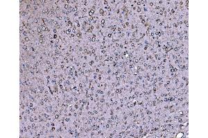 IHC analysis of DLAT using anti-DLAT antibody (ABIN7602307). (DLAT anticorps  (AA 69-642))