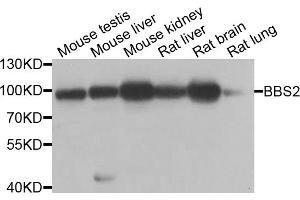 Western blot analysis of extracts of various cell lines, using BBS2 antibody. (BBS2 anticorps)
