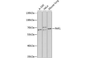 Western blot analysis of extracts of various cell lines, using PHF1 antibody (ABIN6128444, ABIN6145531, ABIN6145532 and ABIN6224513) at 1:1000 dilution. (PHF1 anticorps  (AA 1-260))