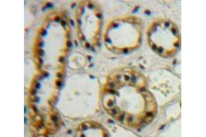 IHC-P analysis of Kidney tissue, with DAB staining. (CYP27B1 anticorps  (AA 258-504))