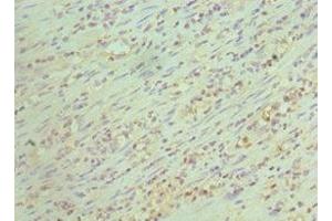 Immunohistochemistry of paraffin-embedded human epityphlon tissue using ABIN7147161 at dilution of 1:100