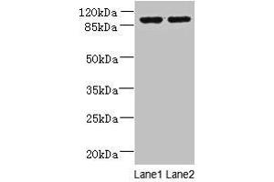 Western blot All lanes: EFHB antibody at 4 μg/mL Lane 1: HepG2 whole cell lysate Lane 2: PC-3 whole cell lysate Secondary Goat polyclonal to rabbit IgG at 1/10000 dilution Predicted band size: 94, 71, 80 kDa Observed band size: 94 kDa (EFHB anticorps  (AA 405-644))