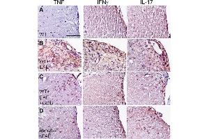 Glibenclamide and Abcc8-/- alter the cytokine profile in EAE.