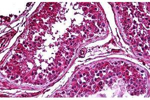 Human Testis: Formalin-Fixed, Paraffin-Embedded (FFPE) (PDK2 anticorps  (AA 187-276))