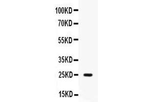 Western blot analysis of Elafin/Skalp expression in human placenta extract ( Lane 1). (PI3 anticorps  (AA 61-117))