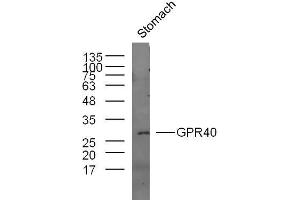 Mouse stomach lysates probed with GPR40 Polyclonal Antibody, unconjugated  at 1:300 overnight at 4°C followed by a conjugated secondary antibody at 1:10000 for 60 minutes at 37°C. (FFAR1 anticorps  (AA 121-220))