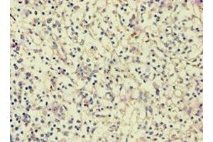 Immunohistochemistry of paraffin-embedded human spleen tissue using ABIN7144082 at dilution of 1:100