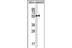 Western blot analysis in MDA-MB453 cell line lysates (35ug/lane). (SOHLH2 anticorps  (AA 232-258))