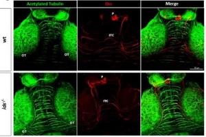 anti-Deleted in Colorectal Carcinoma (DCC) (Middle Region) antibody