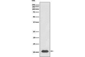Western blot analysis of SDF1 expression in Jurkat cell lysate.