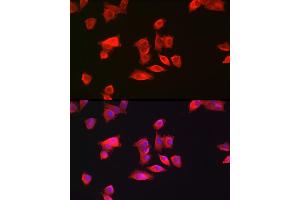 Immunofluorescence analysis of Hep G2 cells using GAMT Rabbit pAb (ABIN6130447, ABIN6140950, ABIN6140951 and ABIN6222280) at dilution of 1:200 (40x lens). (GAMT anticorps  (AA 1-236))