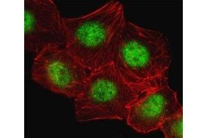 Fluorescent image of A549 cell stained with CREB antibody.