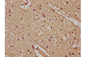 IHC image of ABIN7163520 diluted at 1:100 and staining in paraffin-embedded human brain tissue performed on a Leica BondTM system. (ATP2B4 anticorps  (AA 281-345))