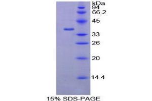 SDS-PAGE analysis of Rat AATF Protein. (AATF Protéine)