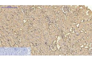 Immunohistochemistry of paraffin-embedded Rat kidney tissue using ACTA2 Monoclonal Antibody at dilution of 1:200. (Smooth Muscle Actin anticorps)