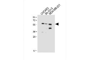 All lanes : Anti-HR2 Antibody (N-term) at 1:1000 dilution Lane 1: OVCAR3 whole cell lysate Lane 2: SK-OV-3 whole cell lysate Lane 3: MDA-MB-231 whole cell lysate Lysates/proteins at 20 μg per lane. (AMHR2 anticorps  (N-Term))