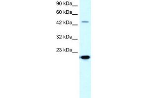 WB Suggested Anti-MMAntibody Titration:  5. (MMP19 anticorps  (C-Term))