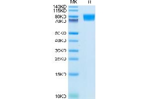 Human CD117 on Tris-Bis PAGE under reduced condition.