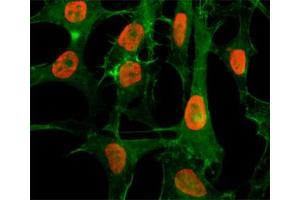 ICC/IF staining of HeLa cells treated with sodium butyrate using recombinant H3K56ac antibody (red).