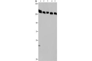 Western Blotting (WB) image for anti-Importin 4 (IPO4) antibody (ABIN2423661) (Importin 4 anticorps)