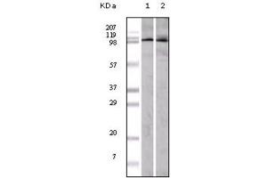 Western blot analysis using EphA1 antibody against A549 (1) and Hela (2) cell lysate. (EPHA1 anticorps)