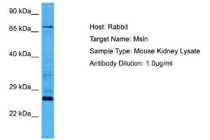 Host:  Mouse  Target Name:  MSLN  Sample Tissue:  Mouse Kidney  Antibody Dilution:  1ug/ml (Mesothelin anticorps  (Middle Region))